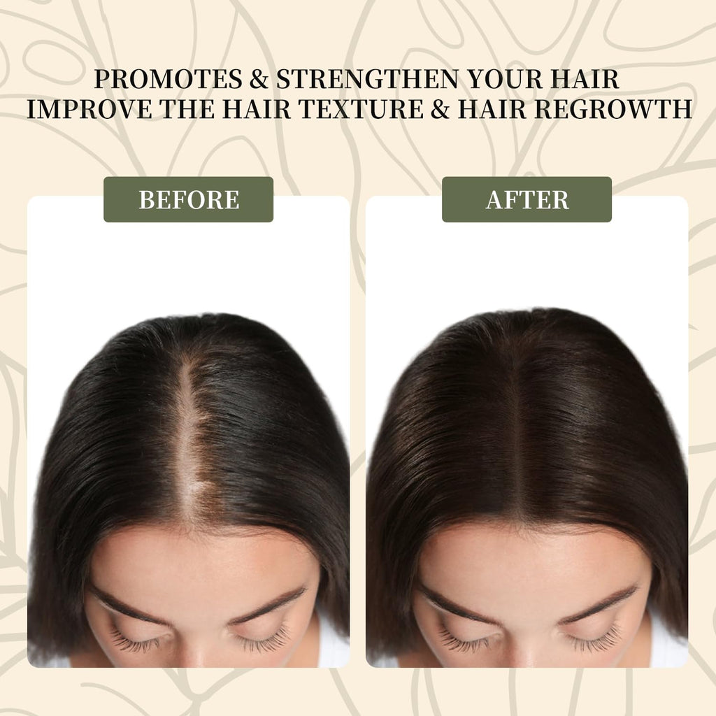 Batana Oil for Hair Growth, 100% Pure Natural, Dr. Sebi Organic Oil from Honduras, 4.2oz Q74112